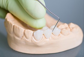 model of teeth and crowns