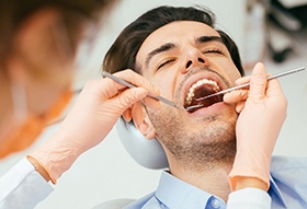 Completely relaxed man undergoing oral examination