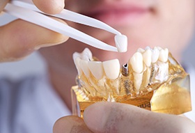 dentist placing a crown on top of a dental implant 