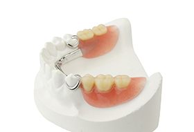 White model jaw with a partial denture on a white background