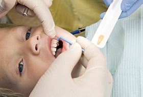 young child receiving dental checkup