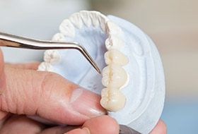 Longview Restorative Dentistry model of teeth