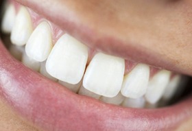 Close up of smile after occlusal adjustment