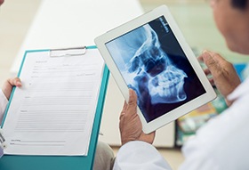 Dentist holding tablet with x-ray displayed